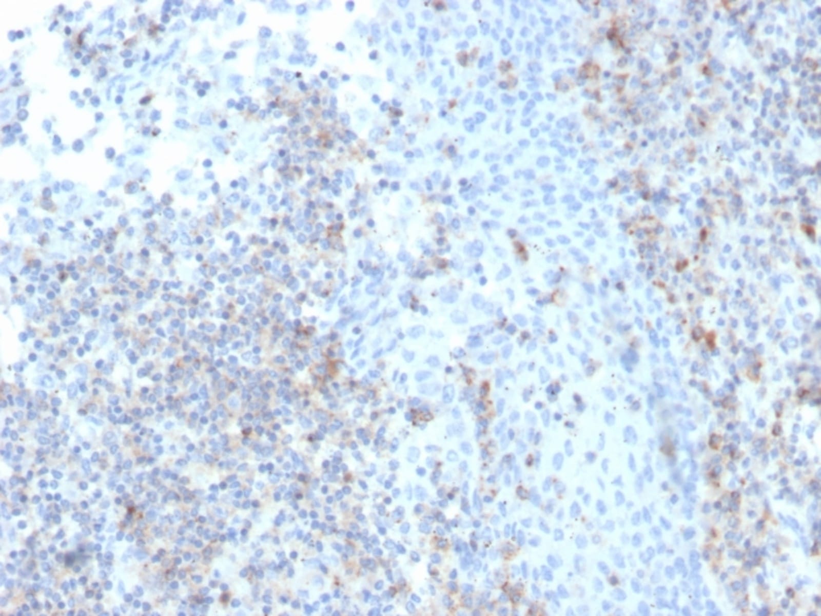 Anti-ICAM3 Mouse Recombinant Antibody [clone: rICAM3/1019] | VWR, part ...