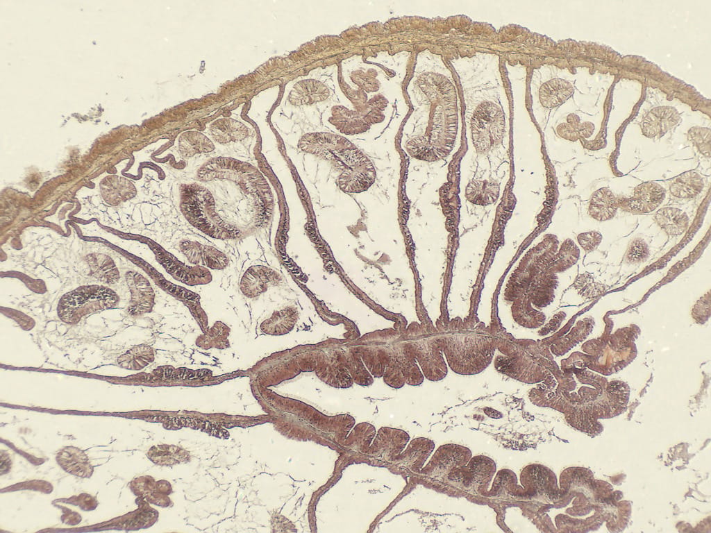 Metridium Composite Slide