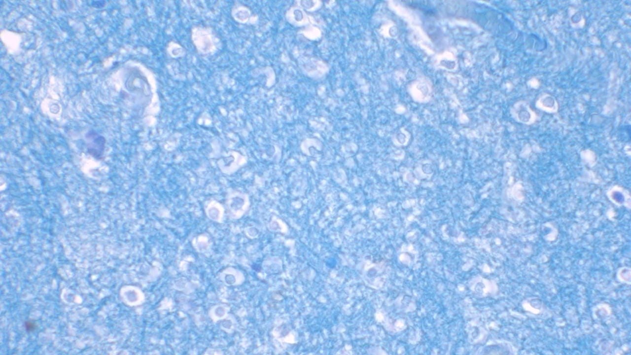 Cerebrum, Section, Luxol Fast Blue and Cresyl Violet Stained Slides