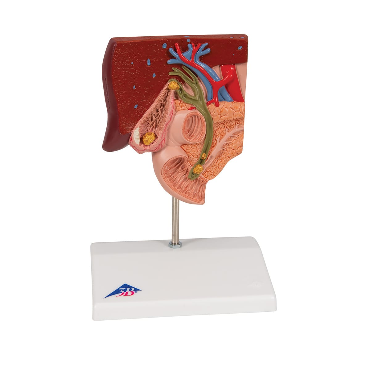 3B Scientific® Gallstones