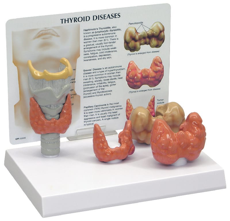 GPI Anatomicals® Thyroid Model