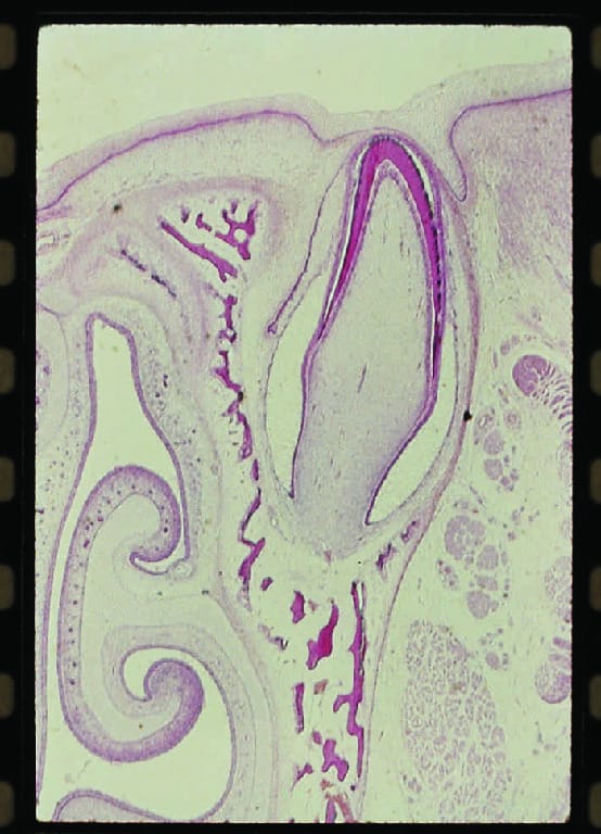Tooth Development Slides