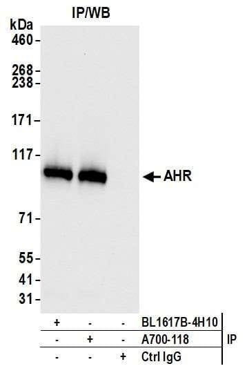 Anti-Aryl hydrocarbon Receptor Rabbit Monoclonal Antibody [clone ...