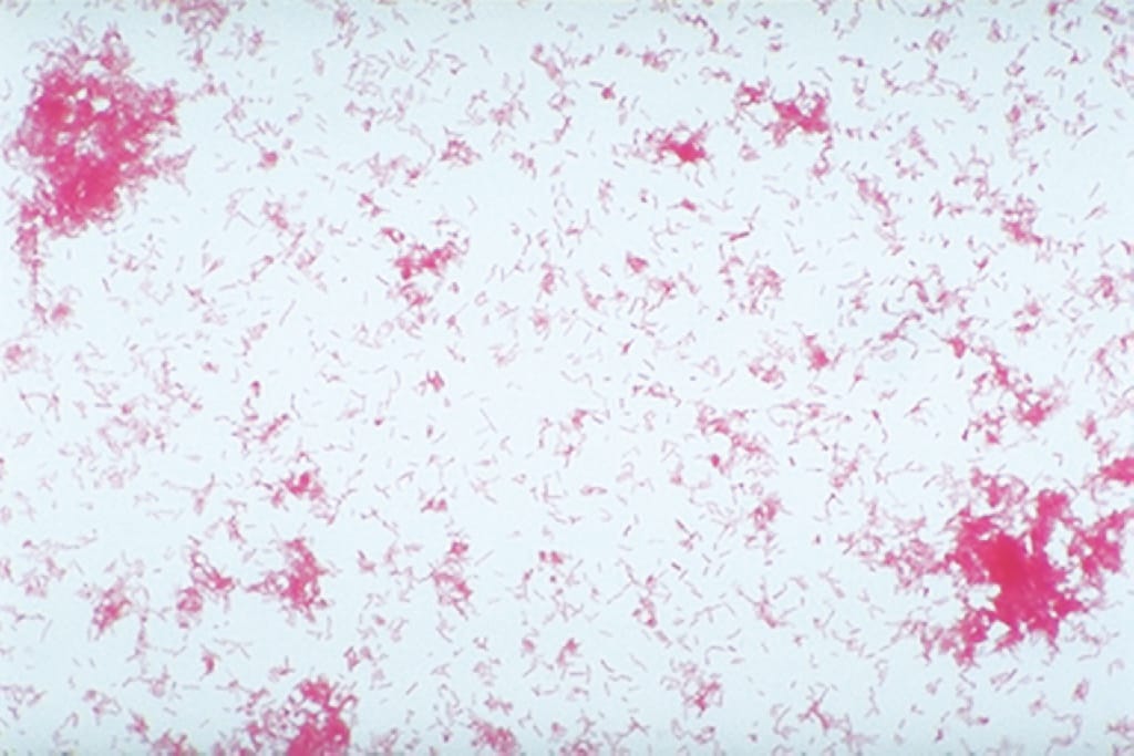 Ward's® Live Proteus hauseri Culture - PATHOGEN