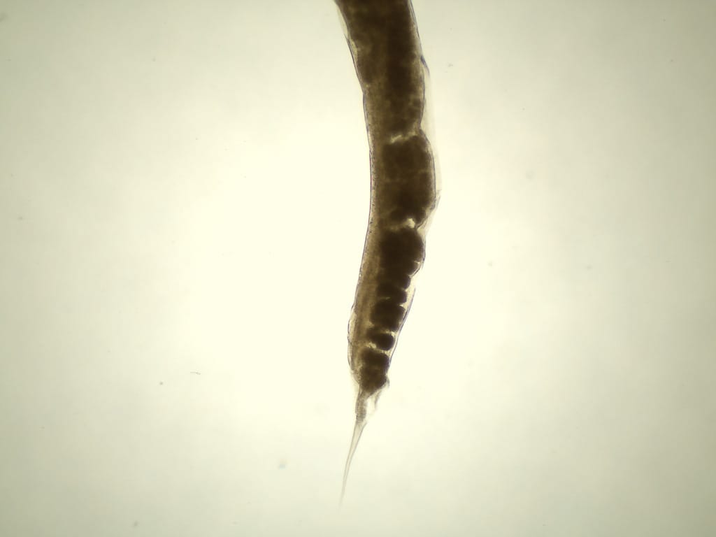 Enterobius vermicularis, Adult Slide