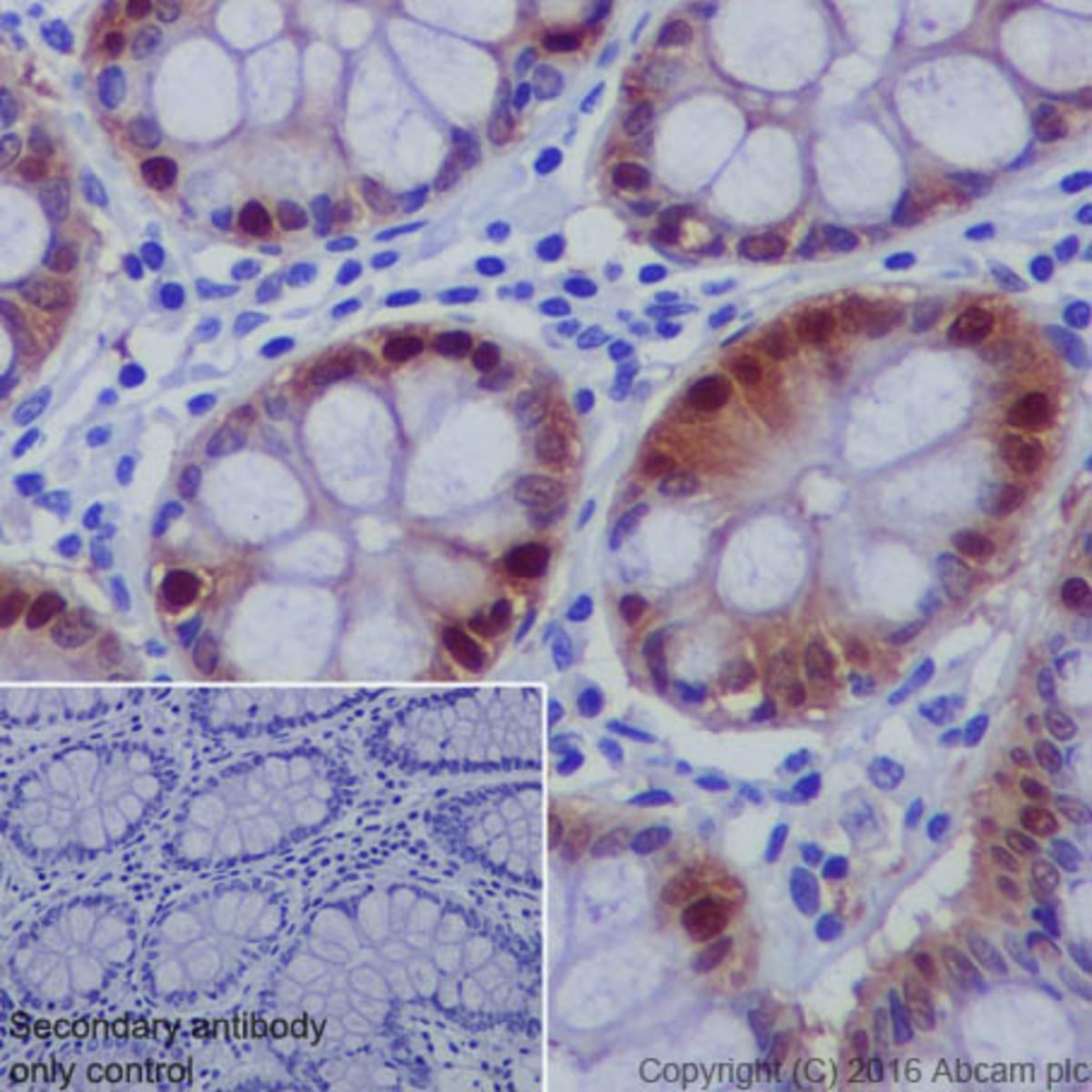 Anti-DARPP32 Rabbit Monoclonal Antibody [clone: EP720Y] | VWR, part of ...