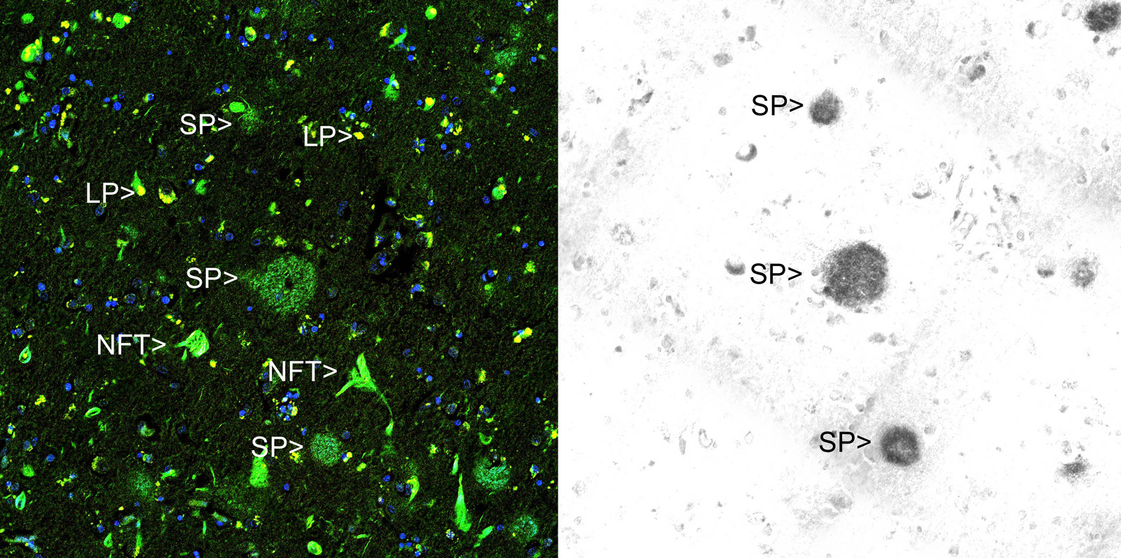 Anti-beta Amyloid Mouse Monoclonal Antibody [clone: AB9] | VWR, part of ...