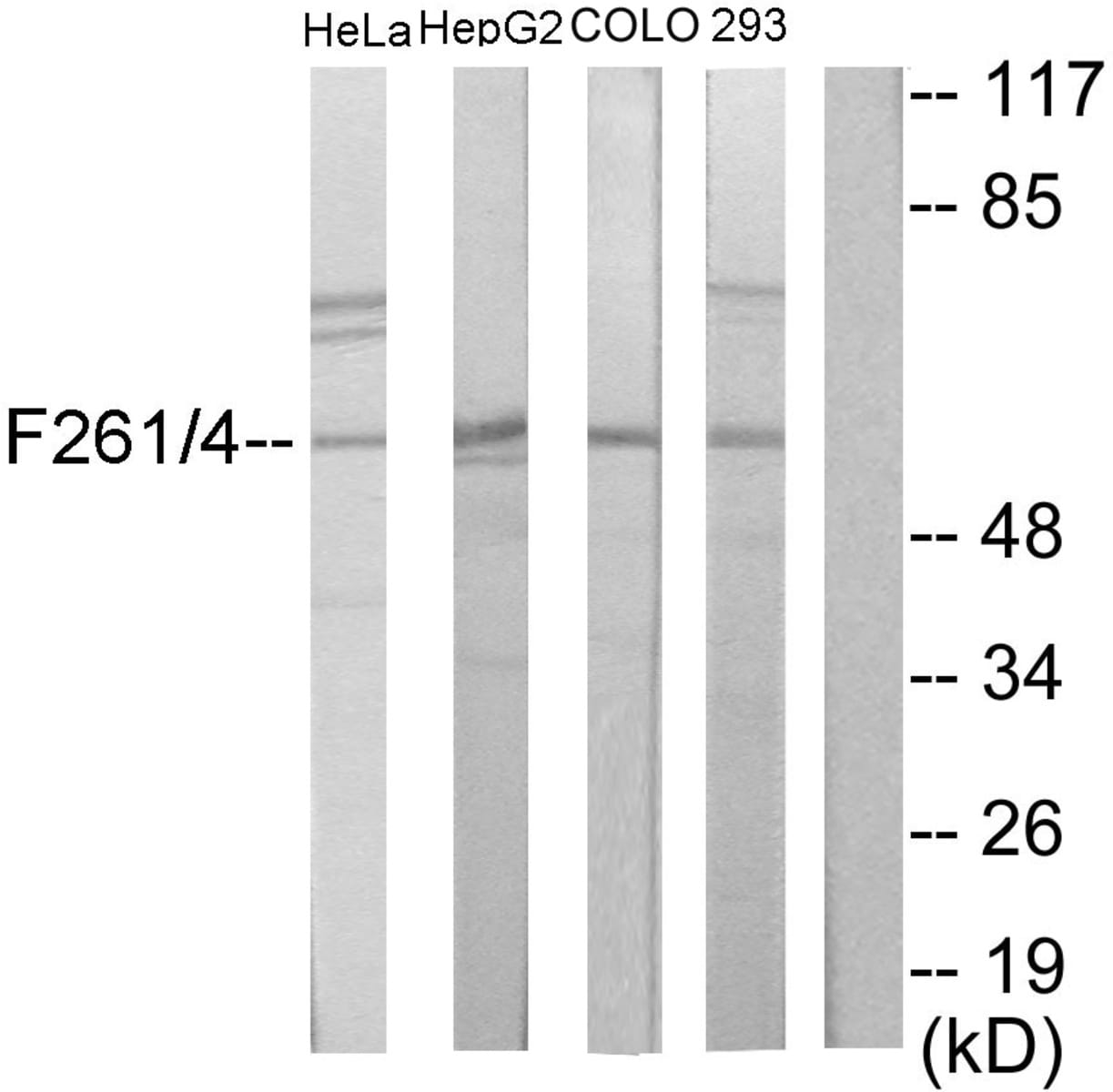 Anti-PFKFB1 + PFKFB4 Rabbit Polyclonal Antibody | VWR, part of Avantor