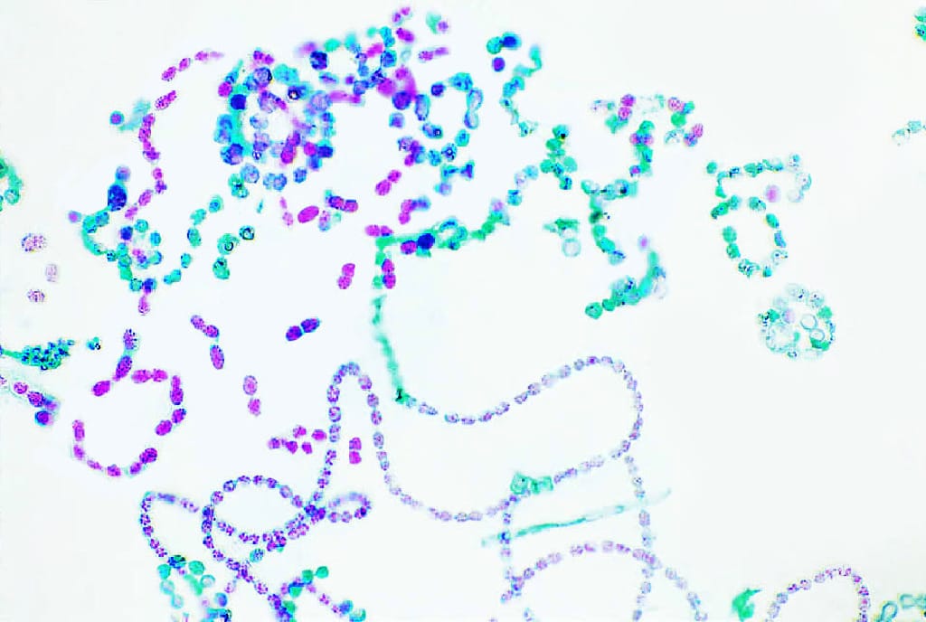 Cyanobacteria and Eubacteria Slide