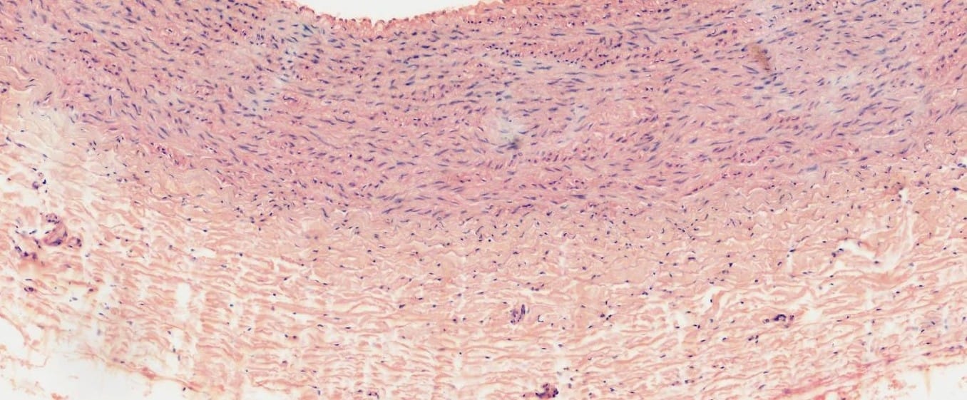 Aorta, Mammal Slide