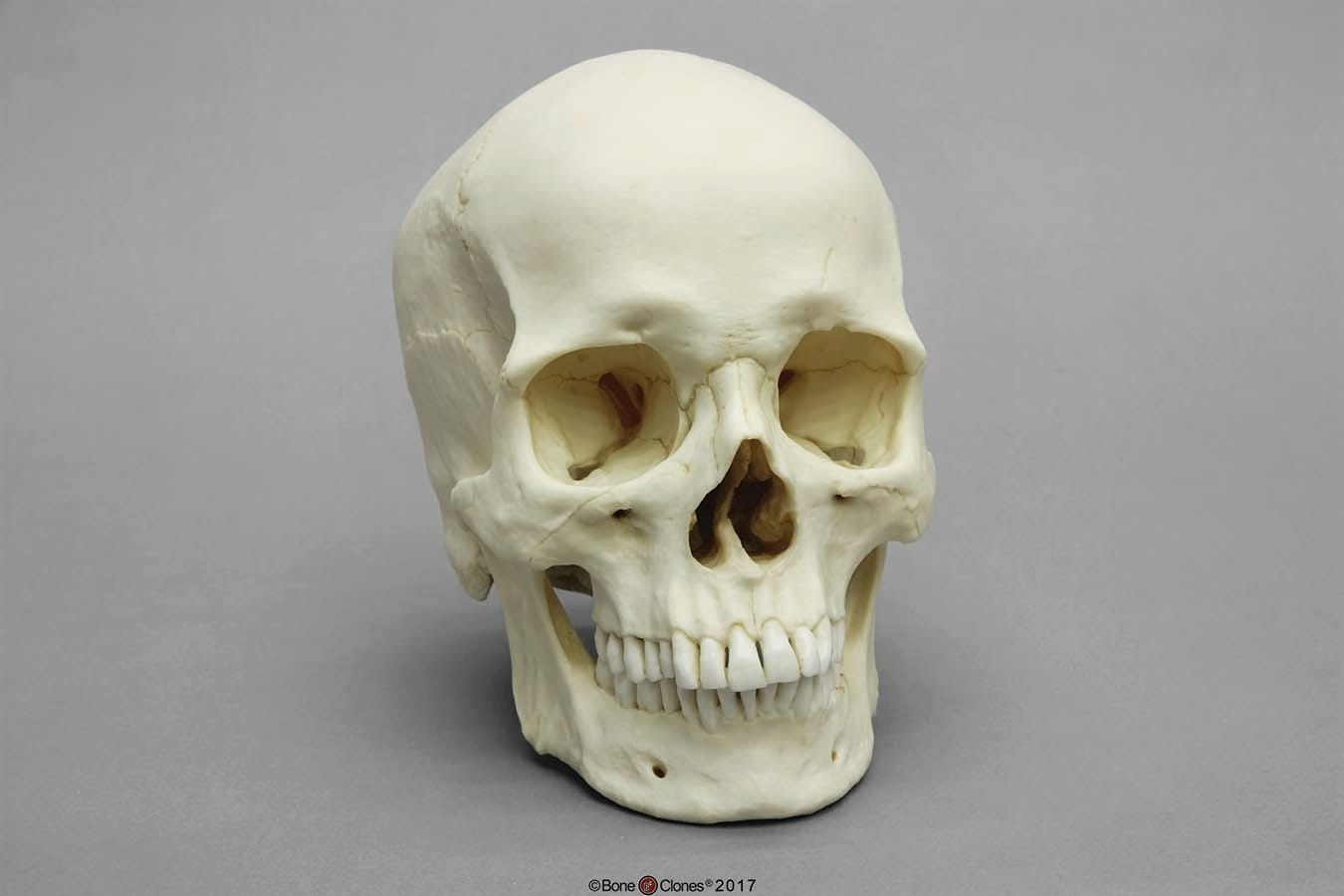 BoneClones® Regional Human Skulls