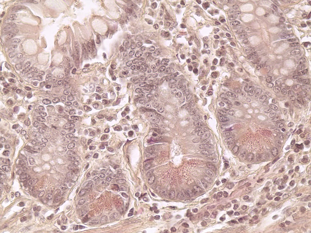 Paneth Cells Slide