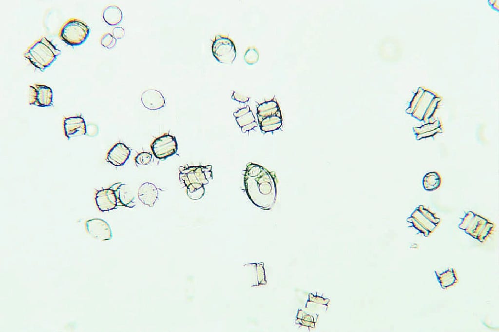 Recent Marine Diatoms Slide