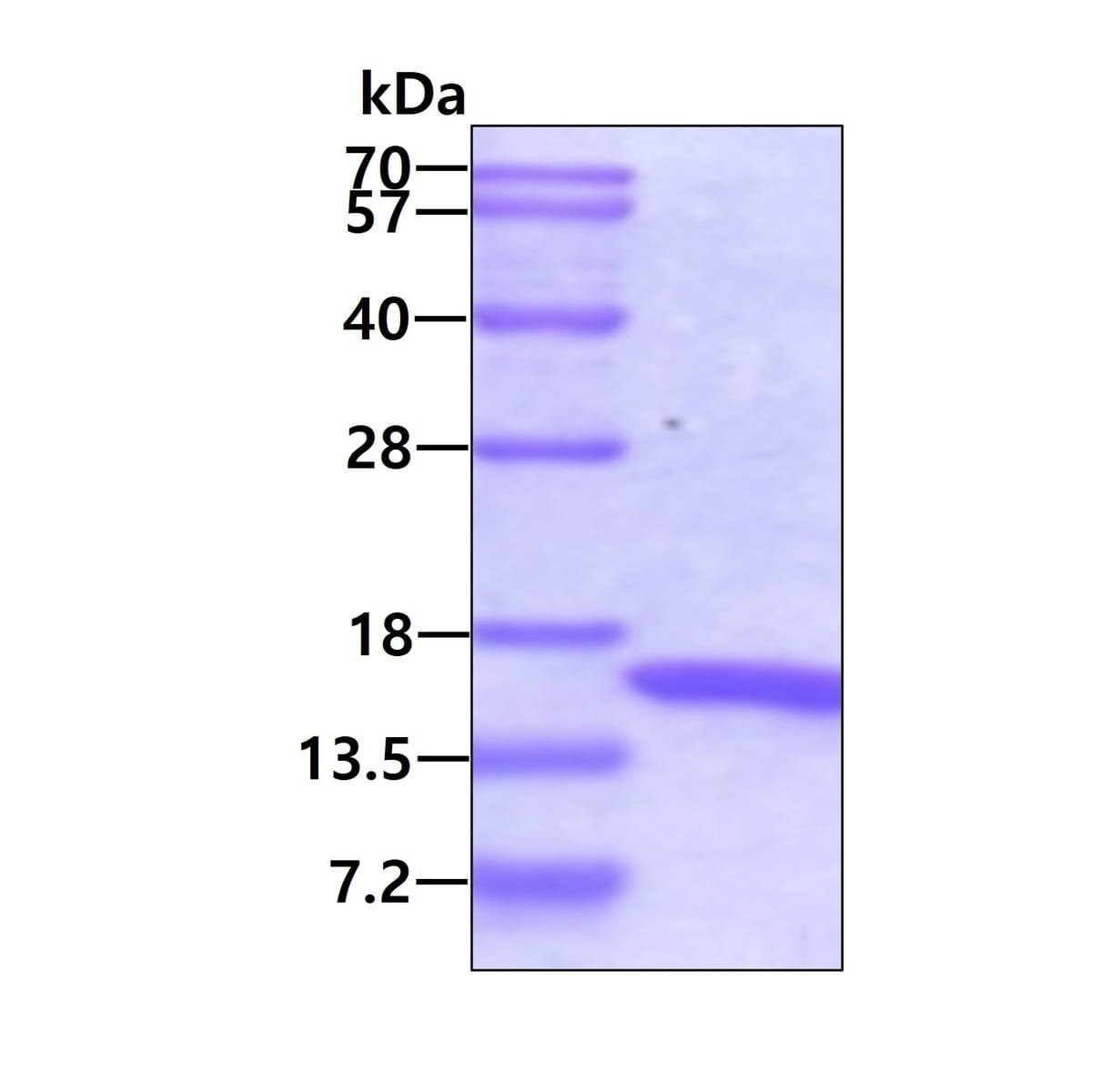 Human Recombinant Retinoid X Receptor alpha/RXRA (from E. coli) | VWR ...