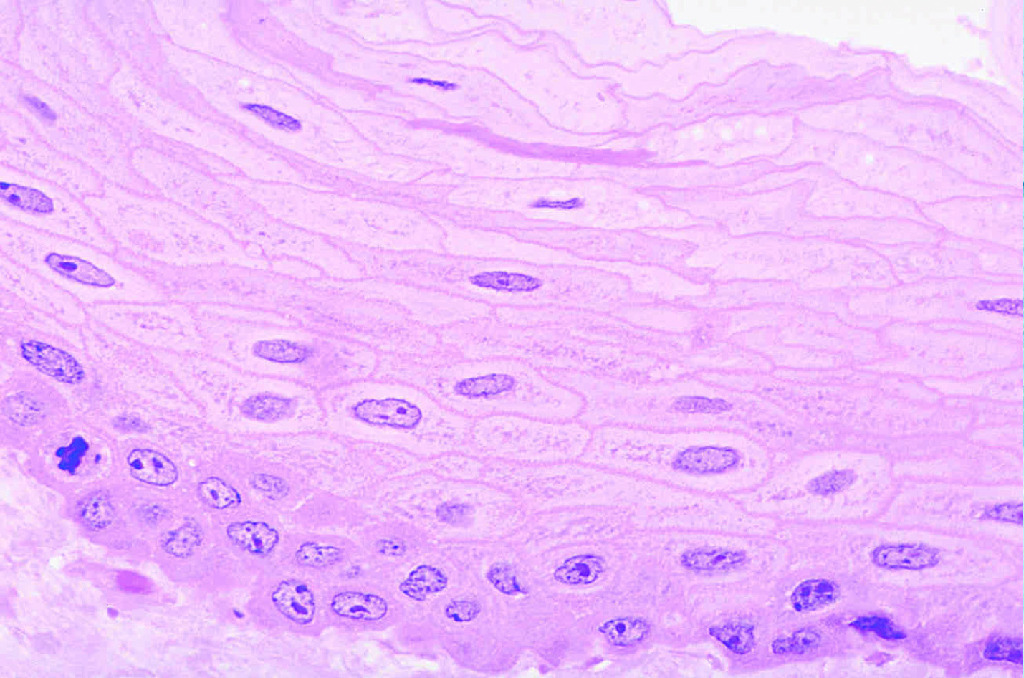 Stratified Squamous Epithelium