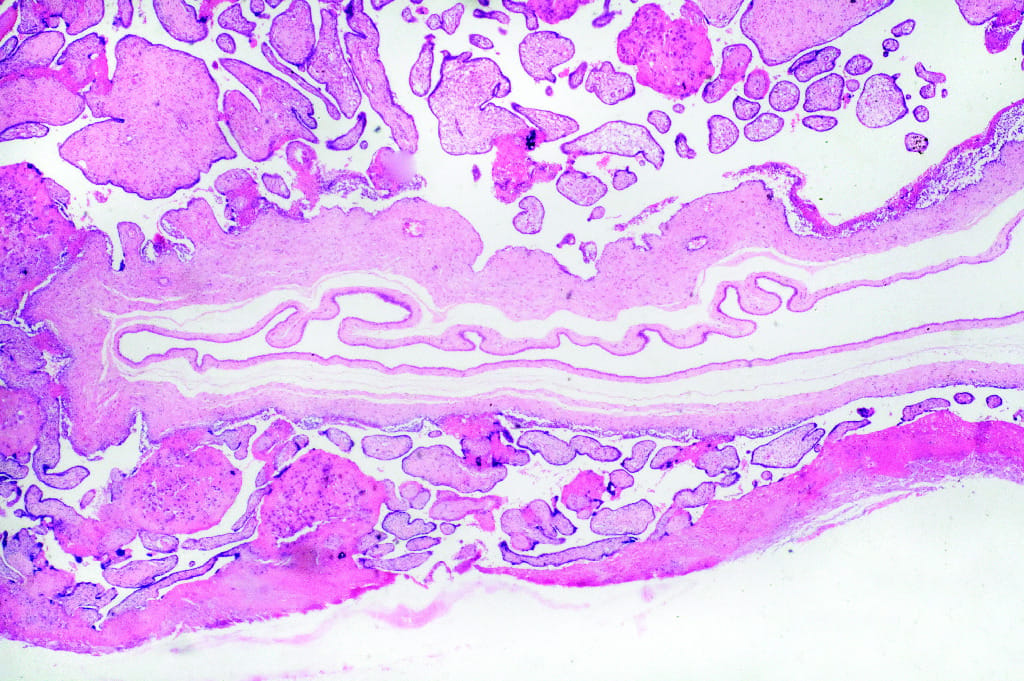 Placenta Slide
