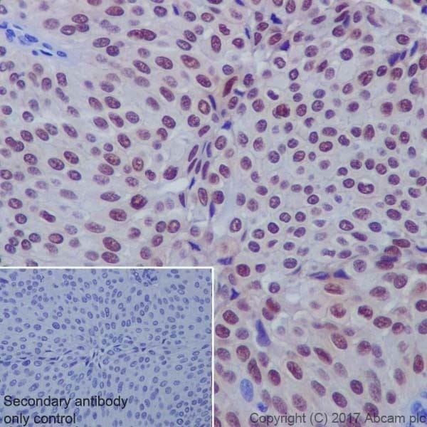 Anti-Annexin A10/ANXA10+Annexin-11/ANXA11 Rabbit Monoclonal Antibody ...