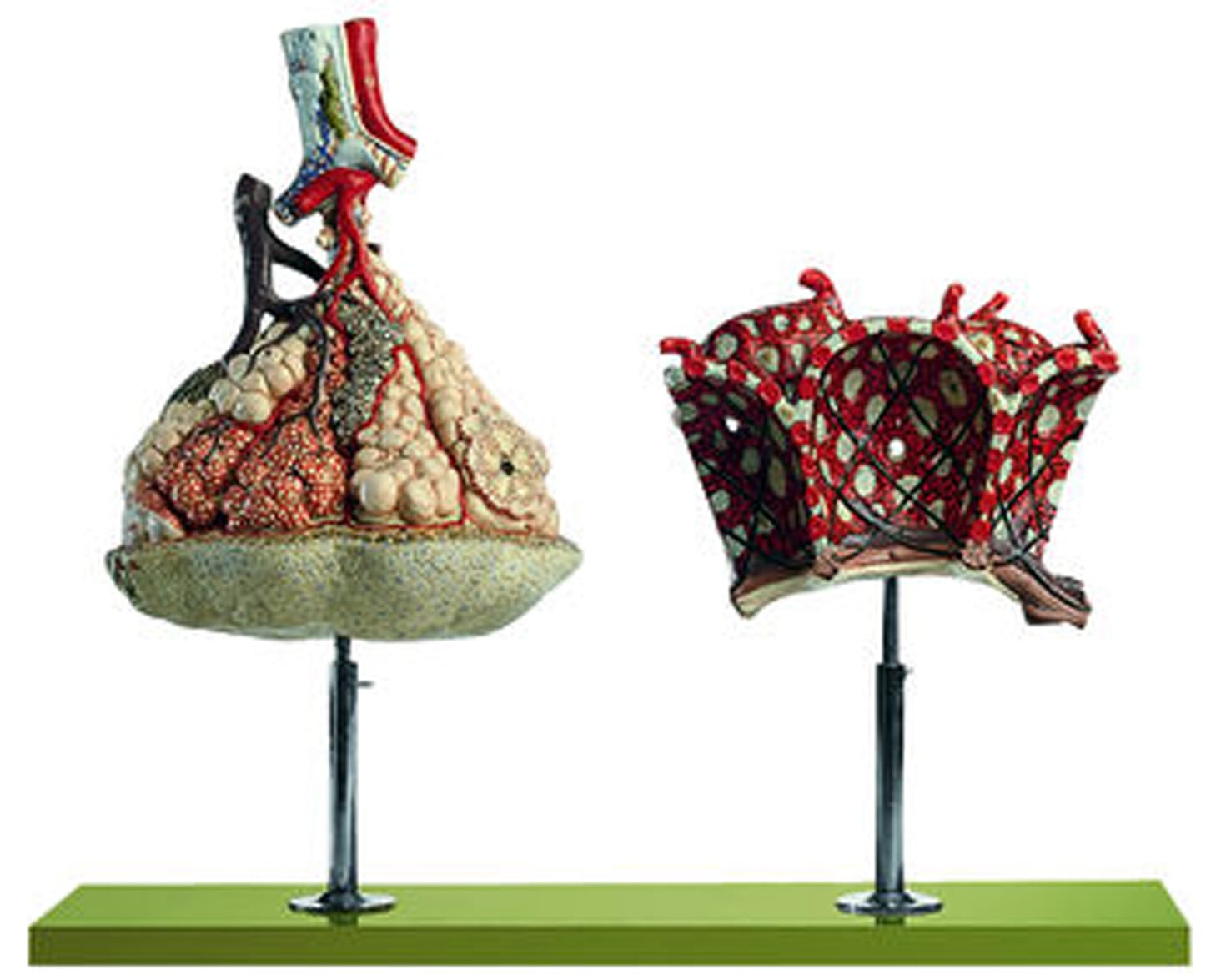 Somso® Lobule of the Lung with Additional Model Pulmonary Alveoli