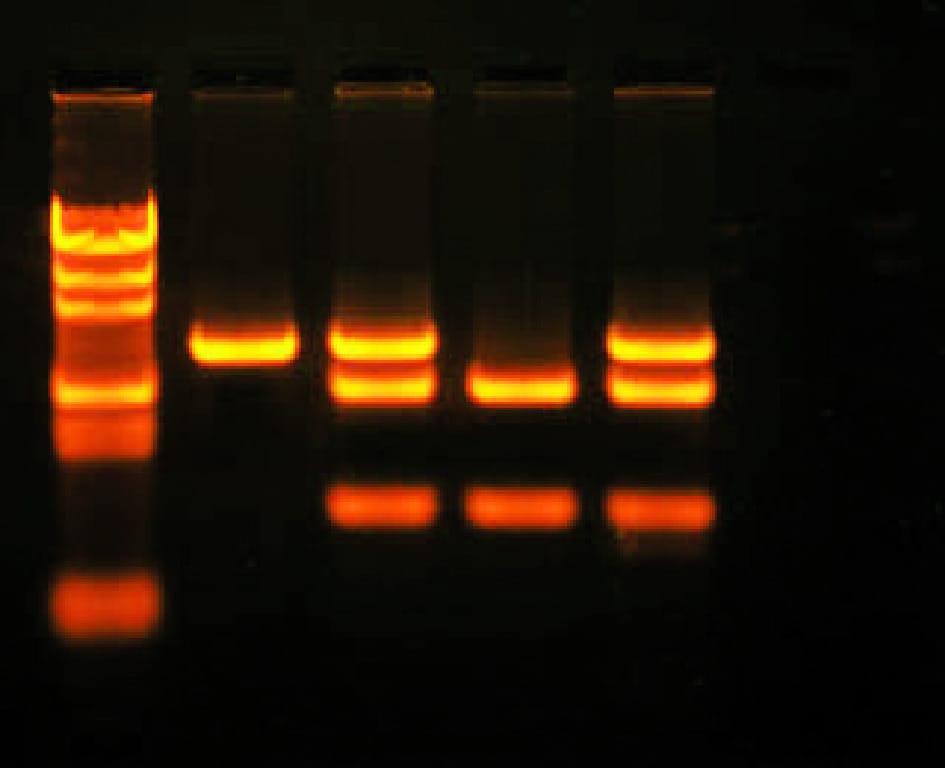 In Search of the Cancer Gene