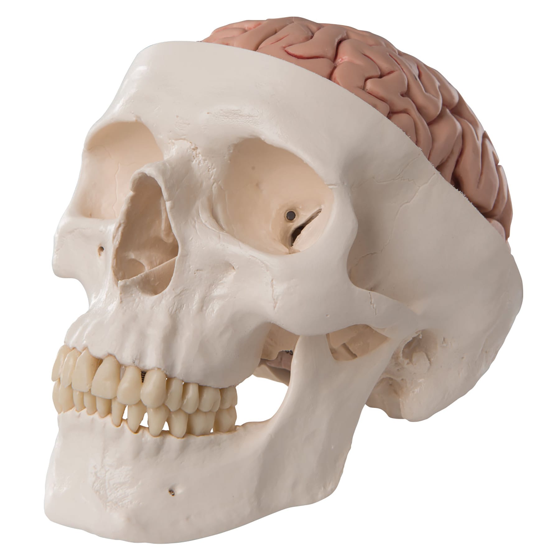 3B Scientific® Skull With 5 Part Brain