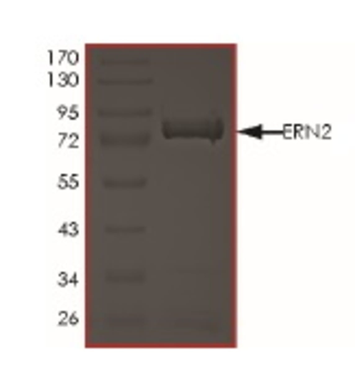 Human Recombinant IRE1b (from Baculovirus (Sf9 Insect cells)) | VWR ...
