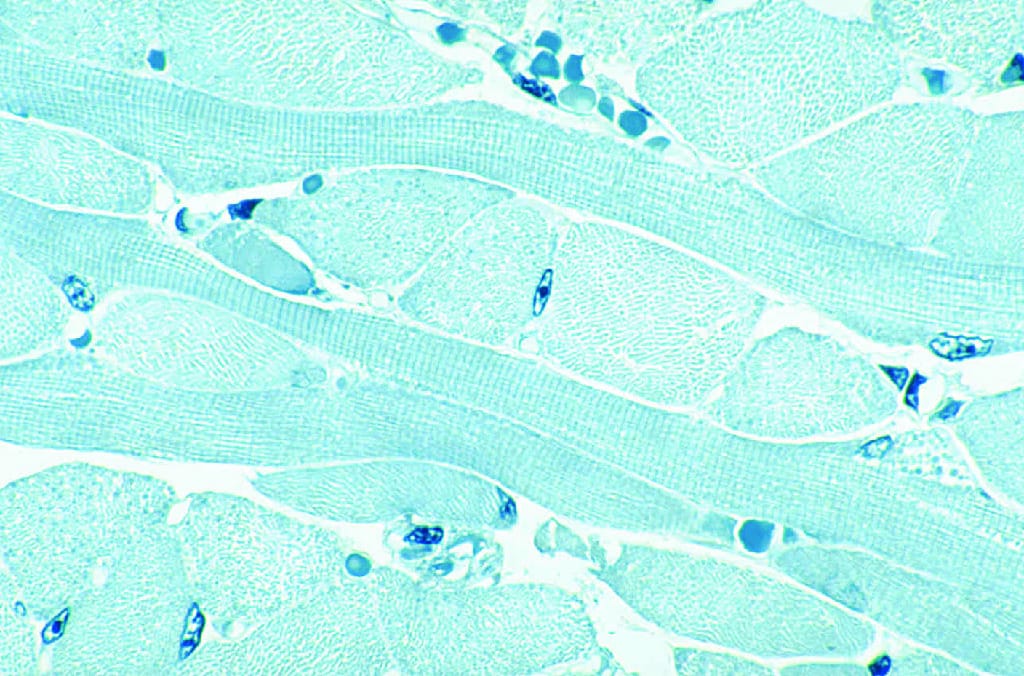 Skeletal Muscle, Striations, Thin Section Slide