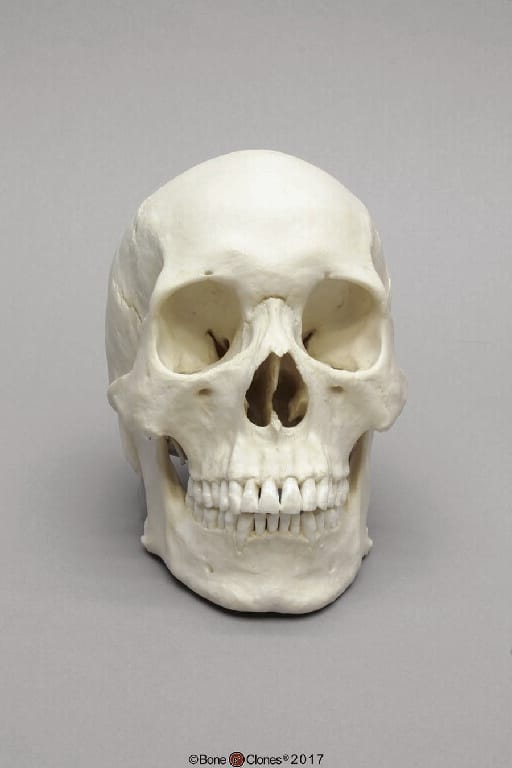 BoneClones® Regional Human Skulls