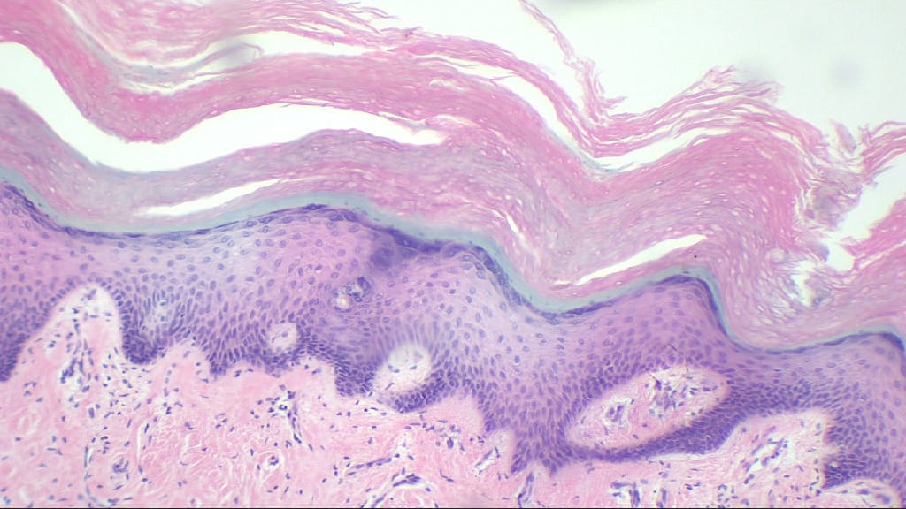 Skin, Cornified, Human Slide