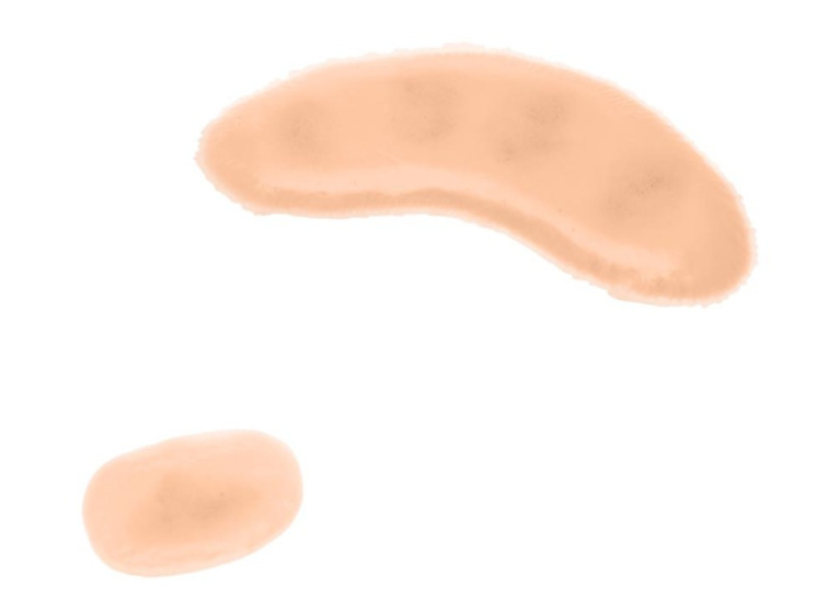 Medicor® Sticky Wounds