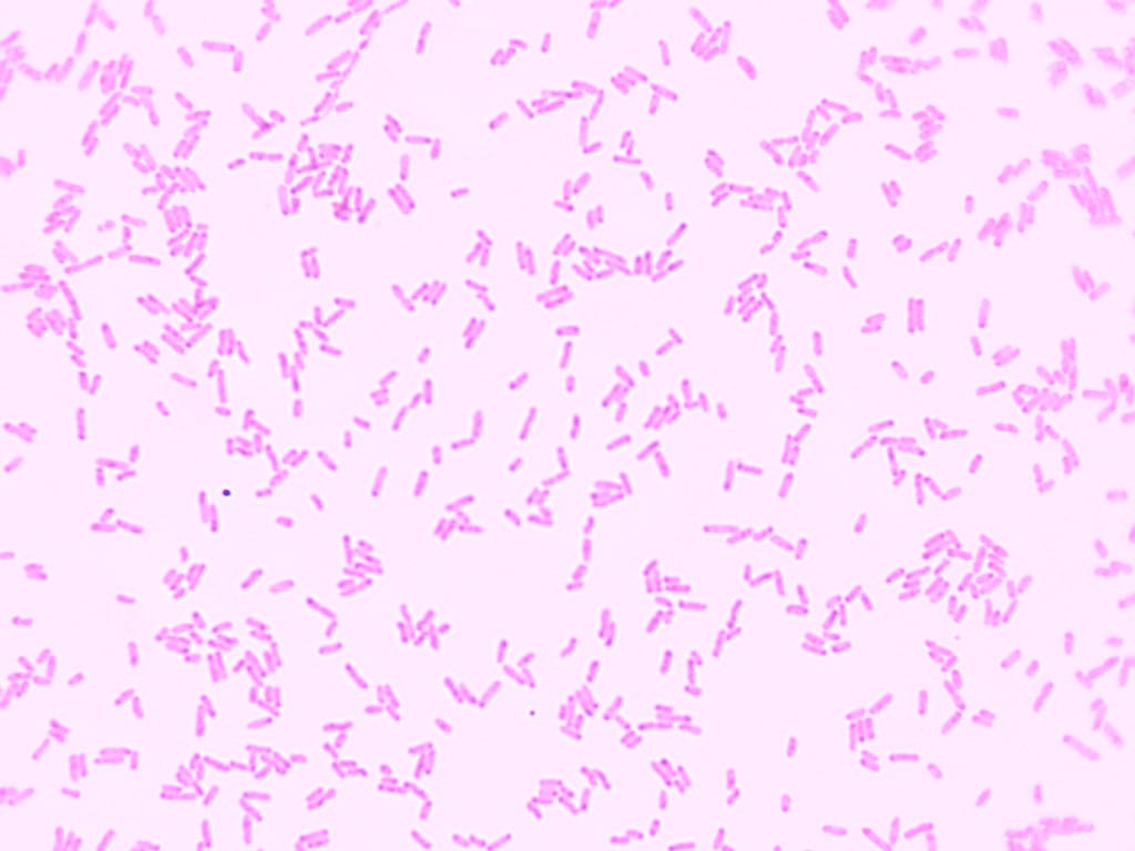 Escherichia coli Slide
