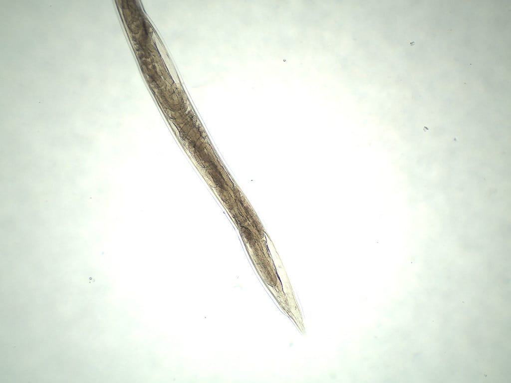 Ancylostoma duodenale, Female Slide
