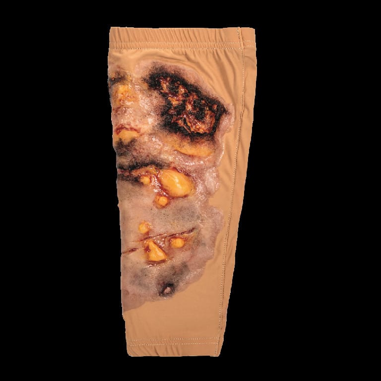 STOPS® Wound Clothing