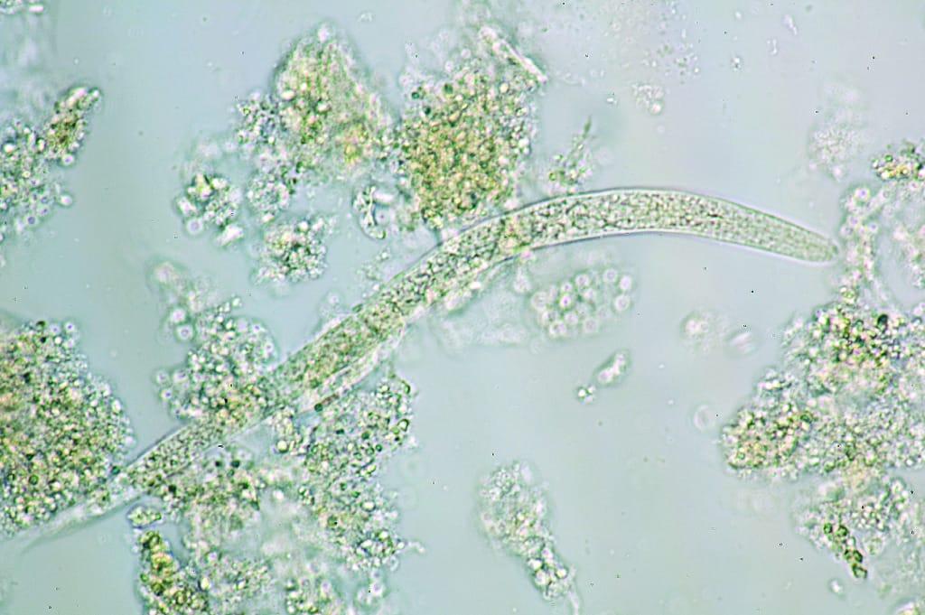 Strongyloides stercoralis, Rhabdiform Larva Slide