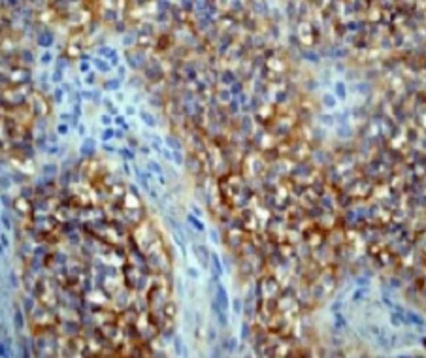 Anti-M-CSF Rabbit Monoclonal Antibody [clone: EP1179Y] | VWR, part of ...