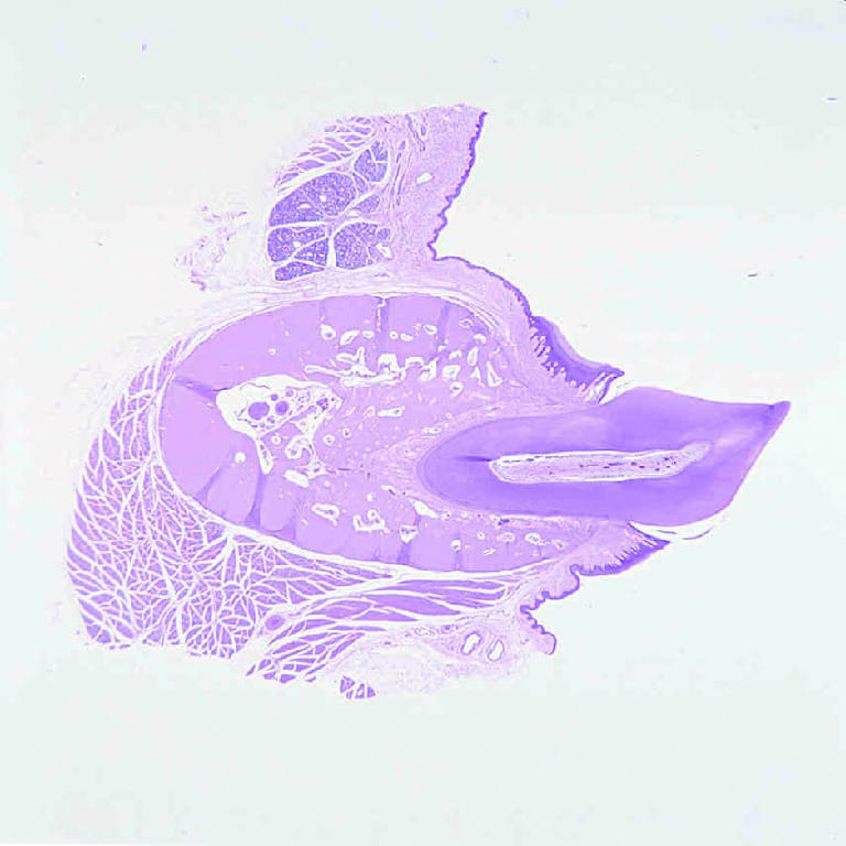 Tooth Development Slides