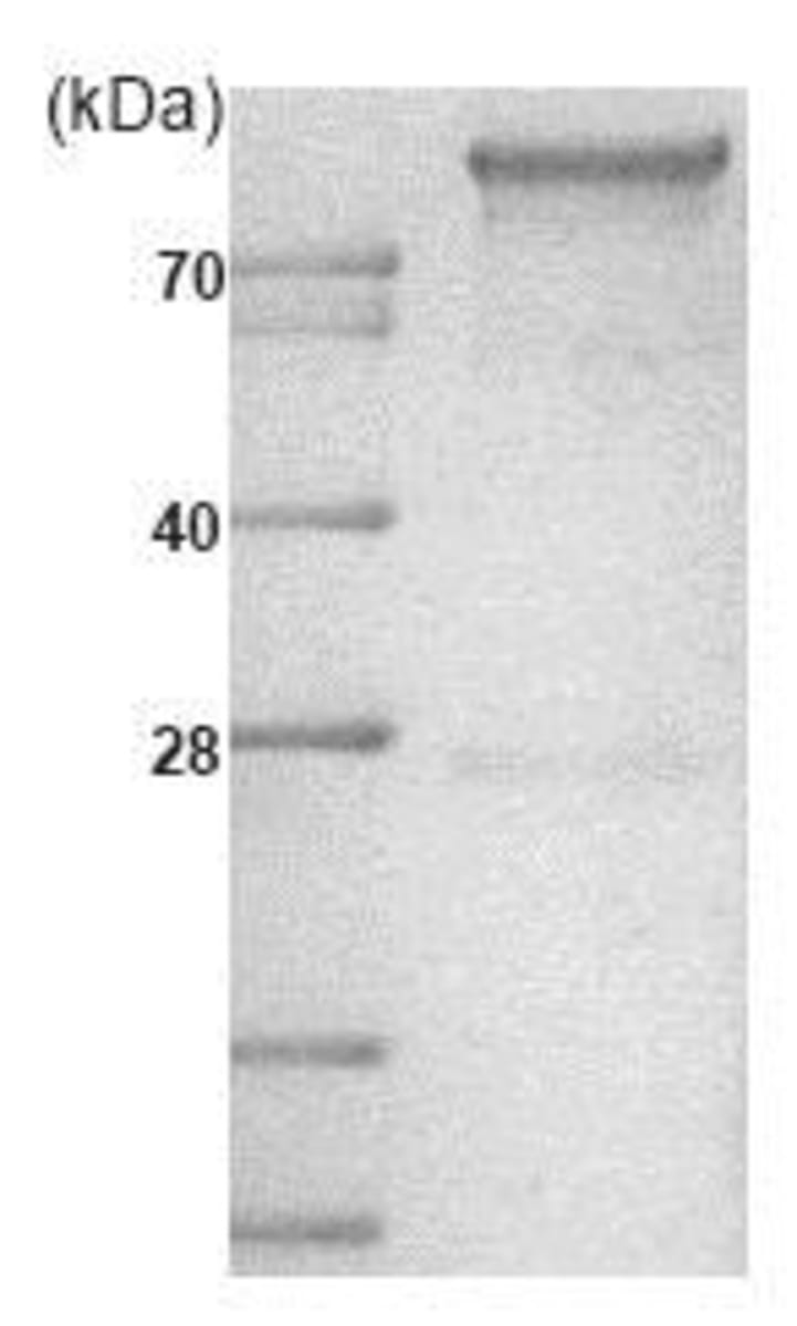 Human Recombinant Hexokinase 1 (from E. coli) | VWR, part of Avantor