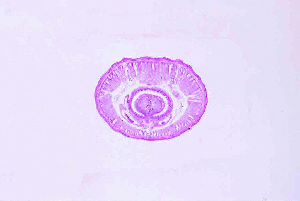 Earthworm, Composite/Three Levels Slide