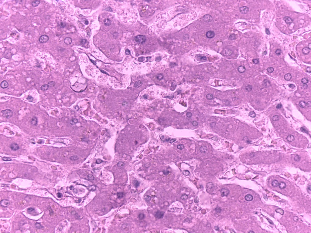 Liver, Human Slide