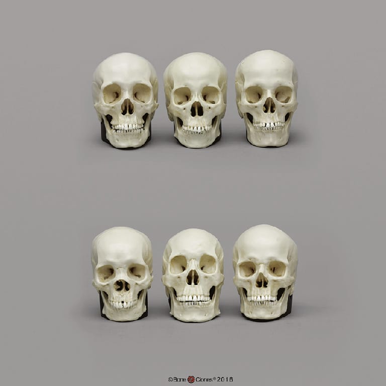 BoneClones® 1:2 Scale Regional Human Skull Sets