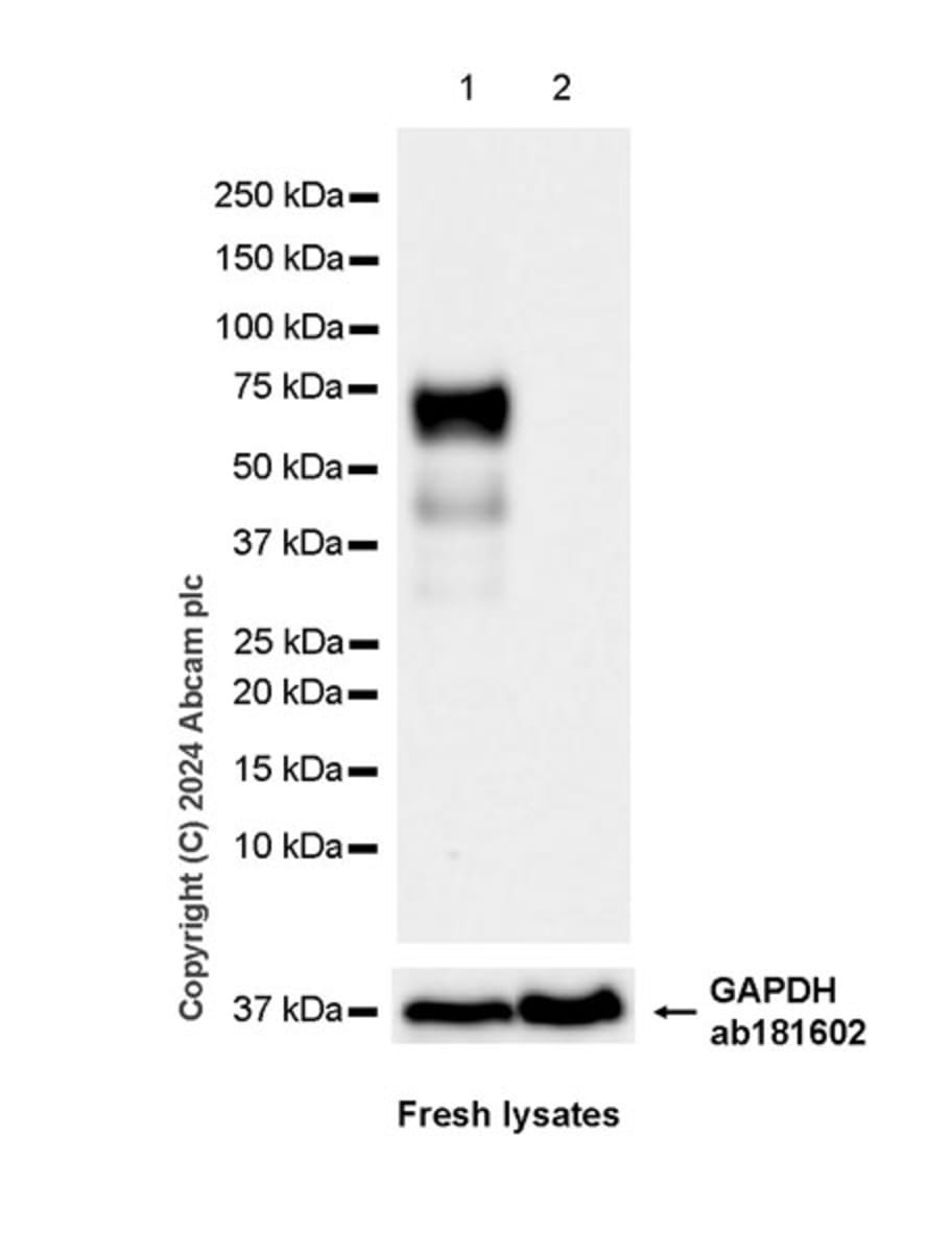 Anti-EZHIP Rabbit Monoclonal Antibody [clone: EPR28396-24] | VWR, part ...