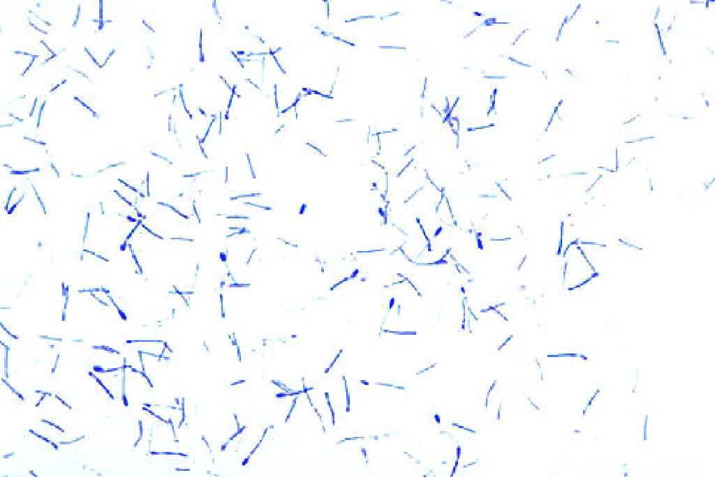 Clostridium tetani Slide