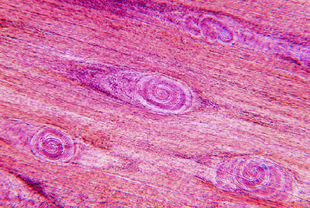 Trichinella spiralis, Encapsulated Larvae Slide