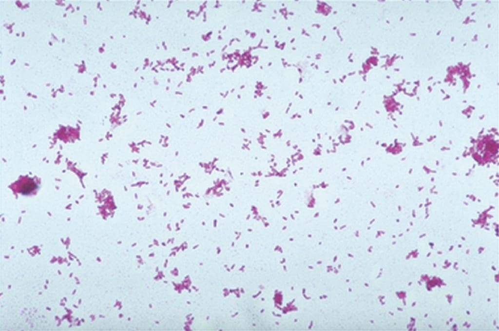 Agrobacterium tumafaciens