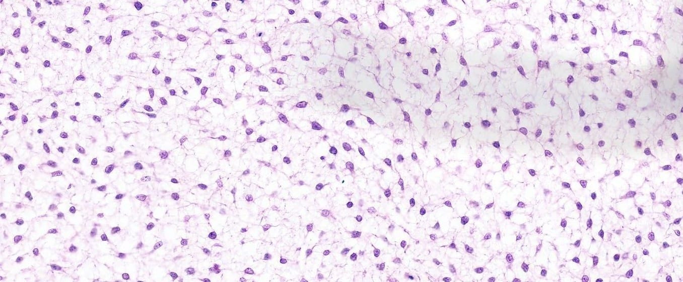 Mesenchyme Slide