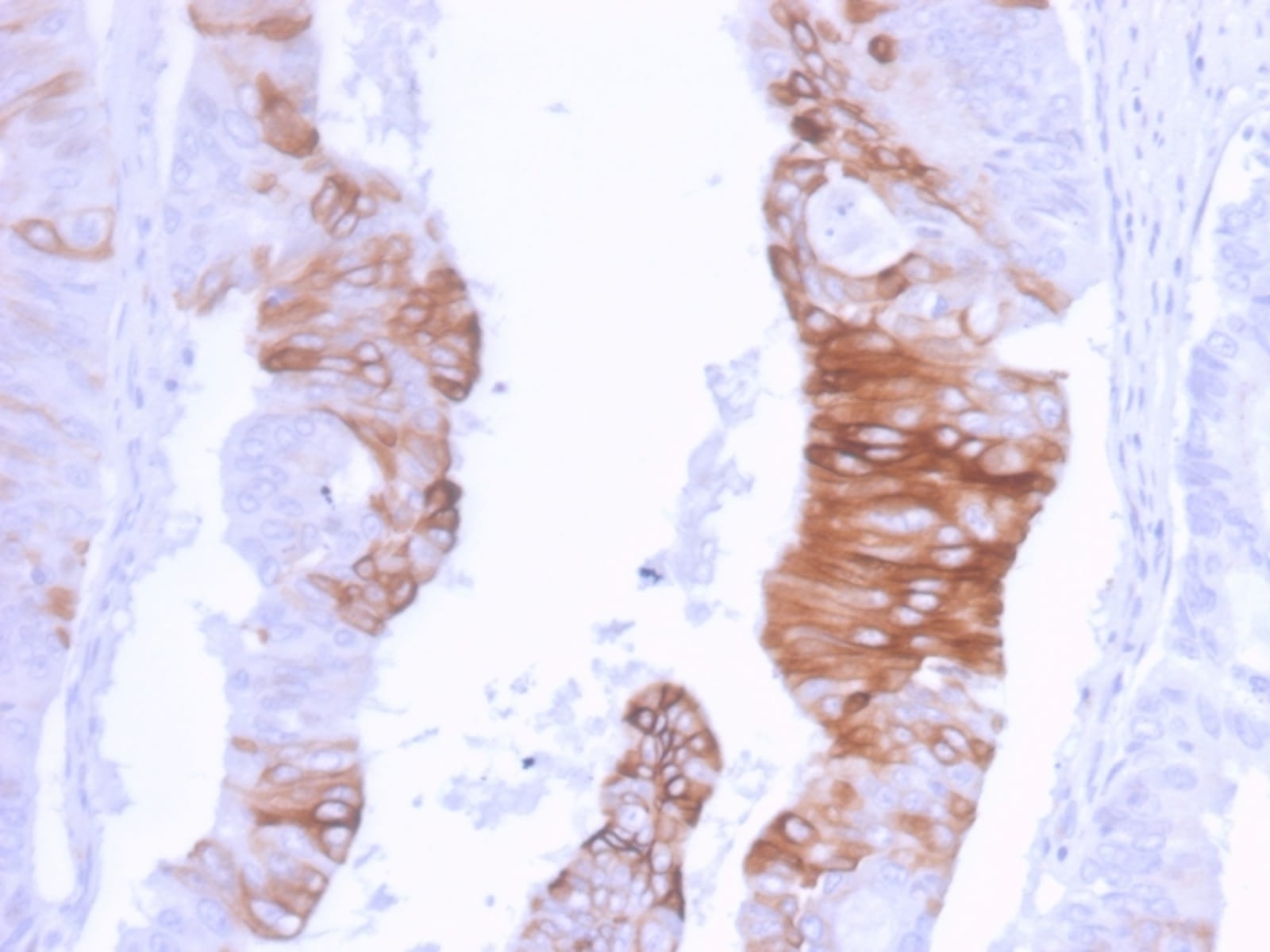 Anti-Cytokeratin 20 Rabbit Recombinant Antibody [clone: KRT20/3129R ...