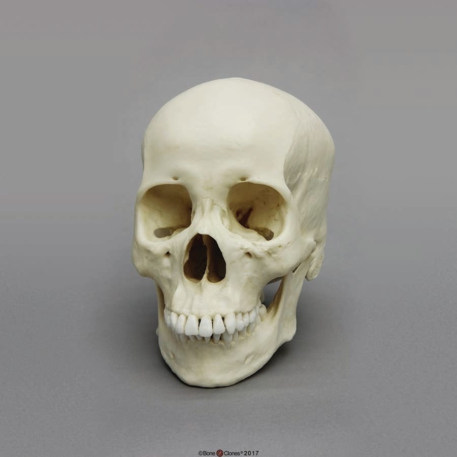 BoneClones® Regional Human Skulls