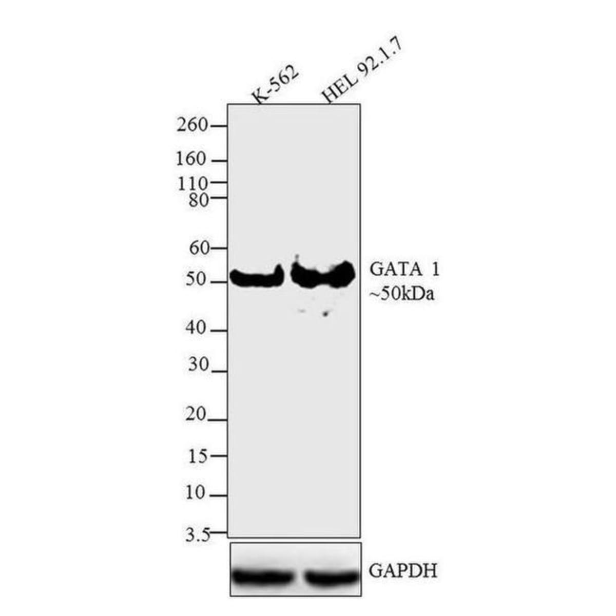 Anti-GATA1 Rabbit Recombinant Multiclonal Antibody [clone: RP23040007 ...