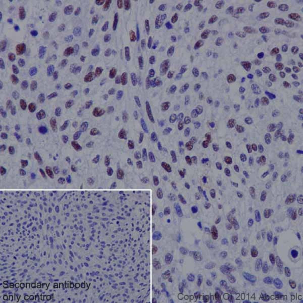 Anti-Rb (phospho T252) Rabbit Monoclonal Antibody [clone: EPR17733 ...
