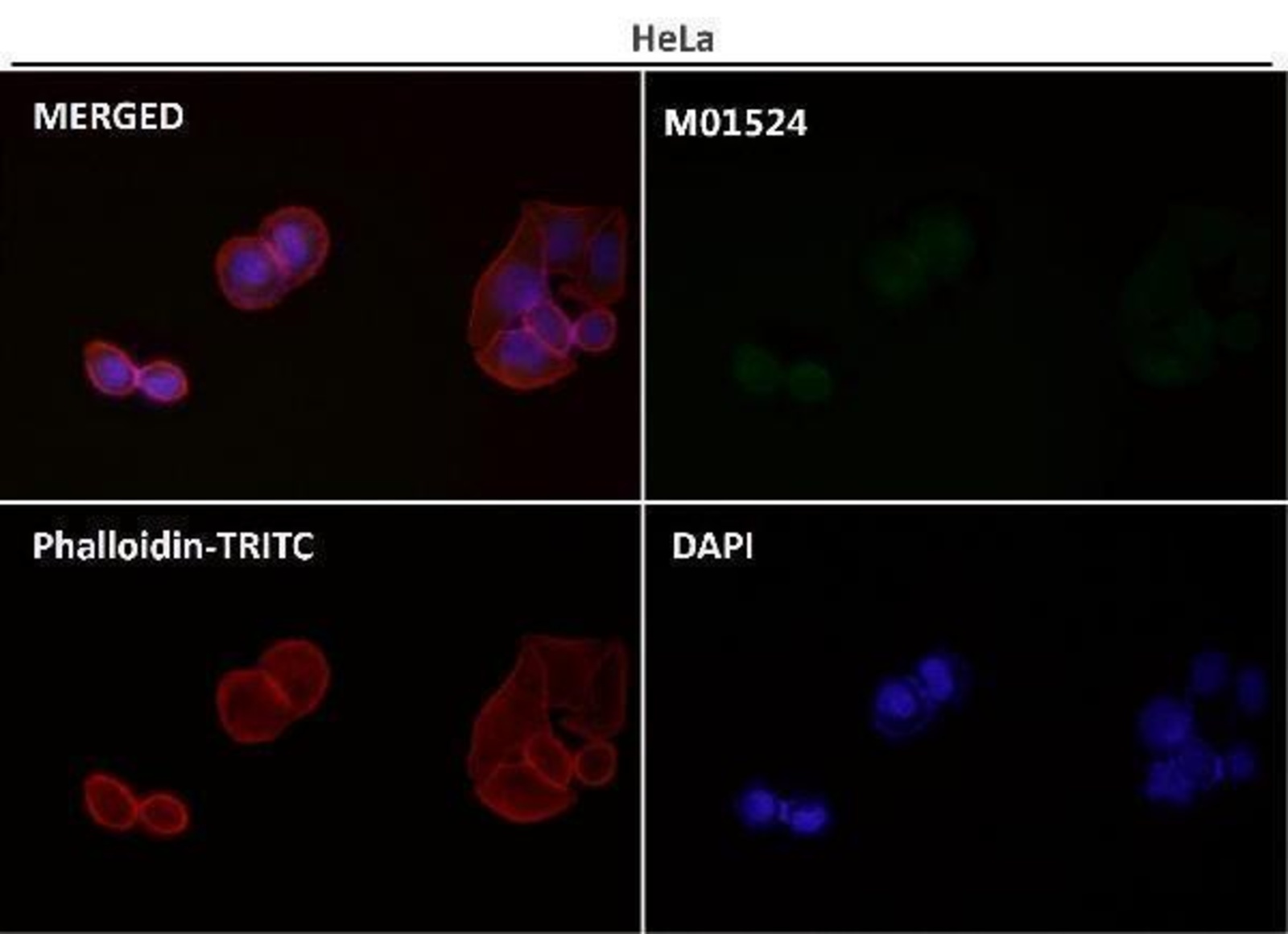 Anti-MAP1LC3B Rabbit Monoclonal Antibody [clone: IEC-13] | VWR, part of ...