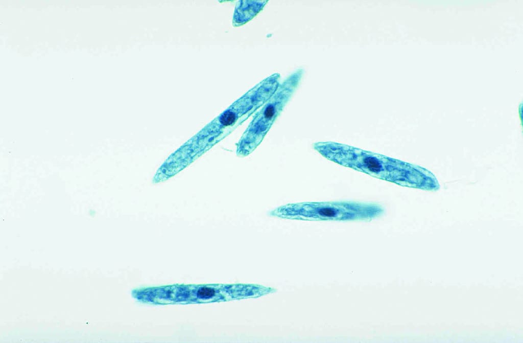 Euglena